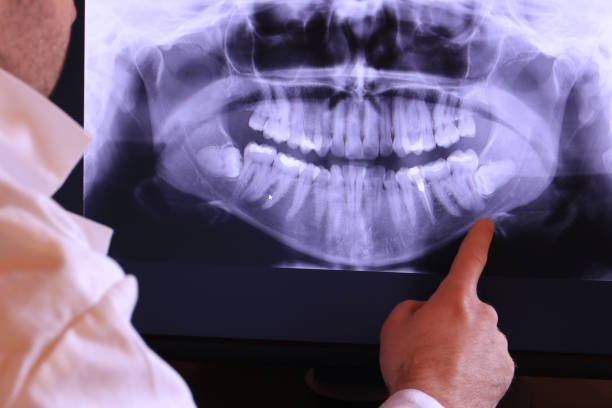 Best Weekend Emergency Dental Services in Nashville, NC