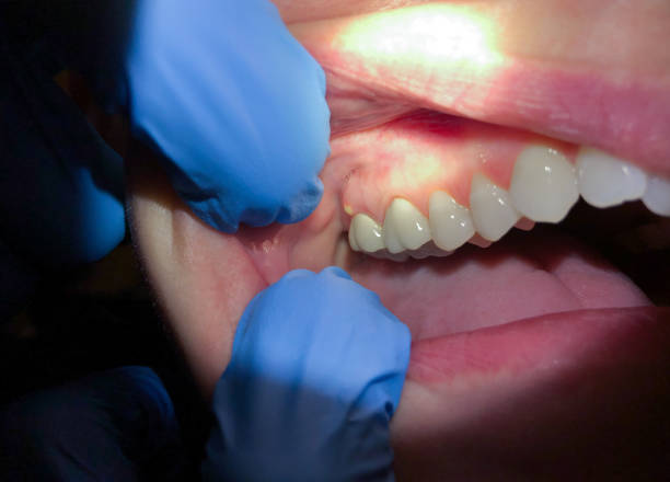 Best Emergency Treatment for Jaw Pain or Injury in Nashville, NC