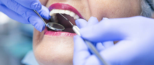 Best Broken or Chipped Tooth Repair in Nashville, NC